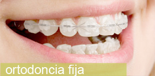 ortodoncia fija